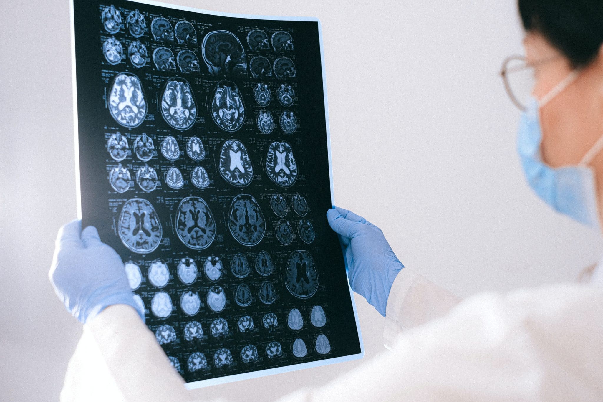 Doctor looking at MRI scan of the brain.