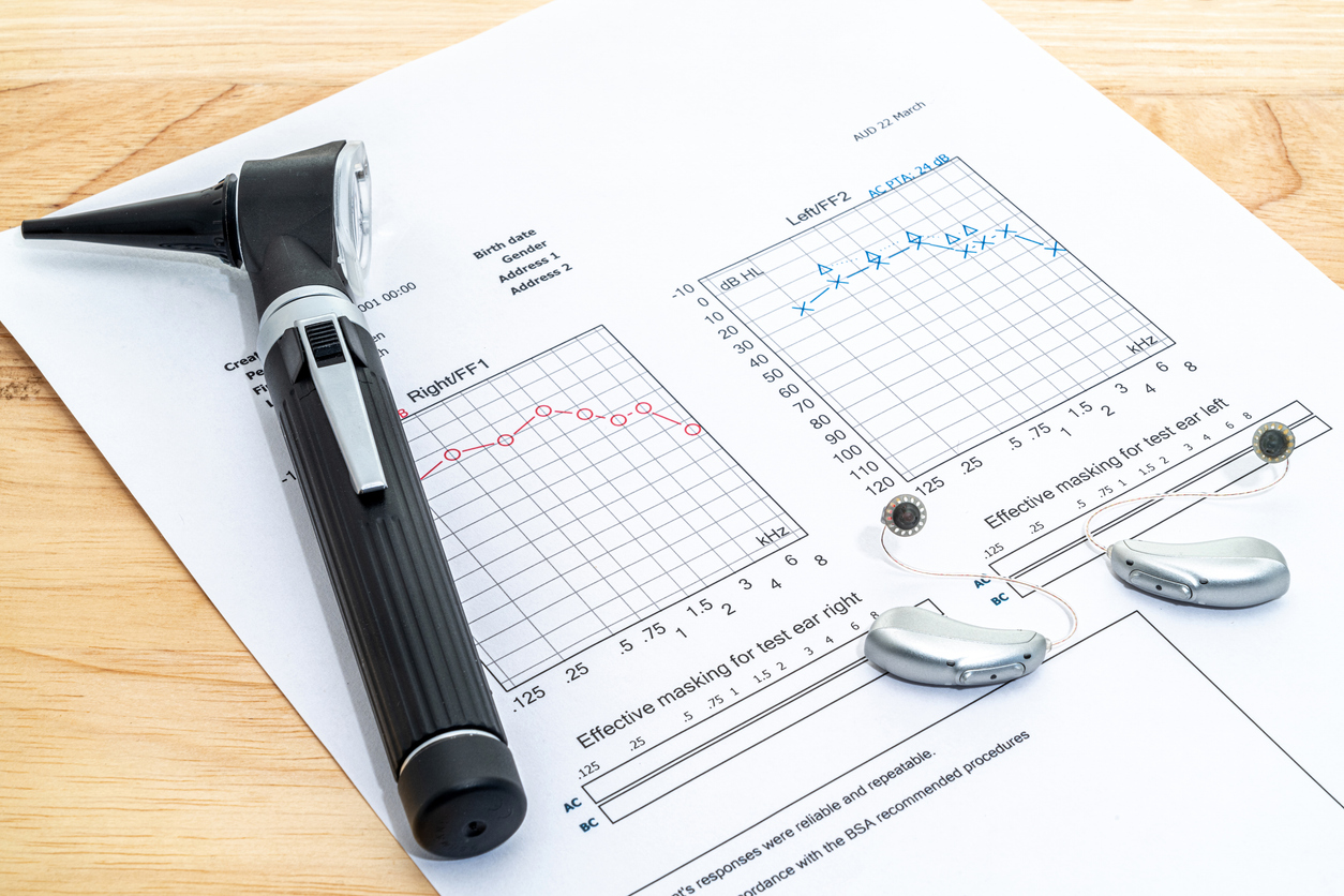 Audiology - hearing aids and an otoscope placed on an audiogram